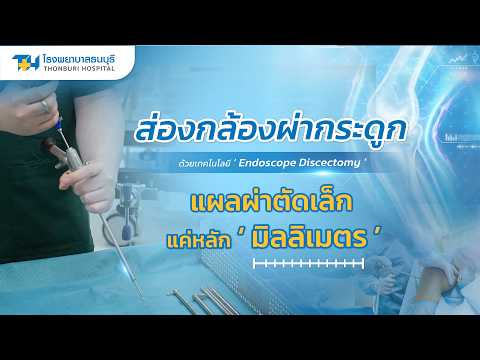 ส่องกล้องผ่ากระดูกสันหลัง โดย นพ.ศิรวิชญ์ สุวิทยะศิริ
